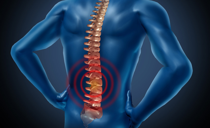 DIscectomy-2