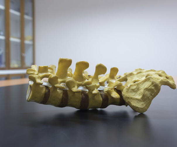 Lumbar Sympathetic Blocks