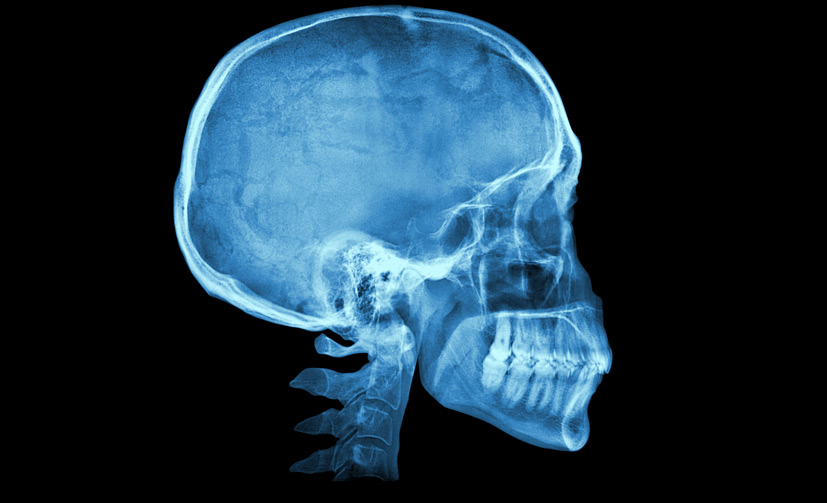 Skull-Base-Surgery-1