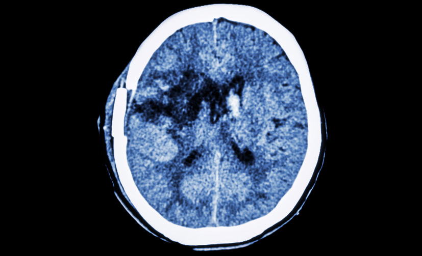 Skull-Base-Surgery-3