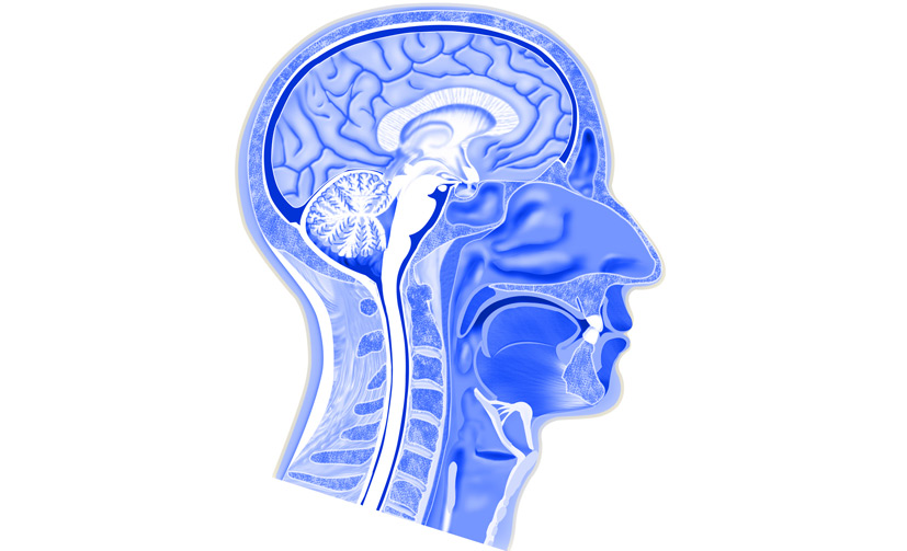 Trigeminal-Neuralgia-Surgery-2
